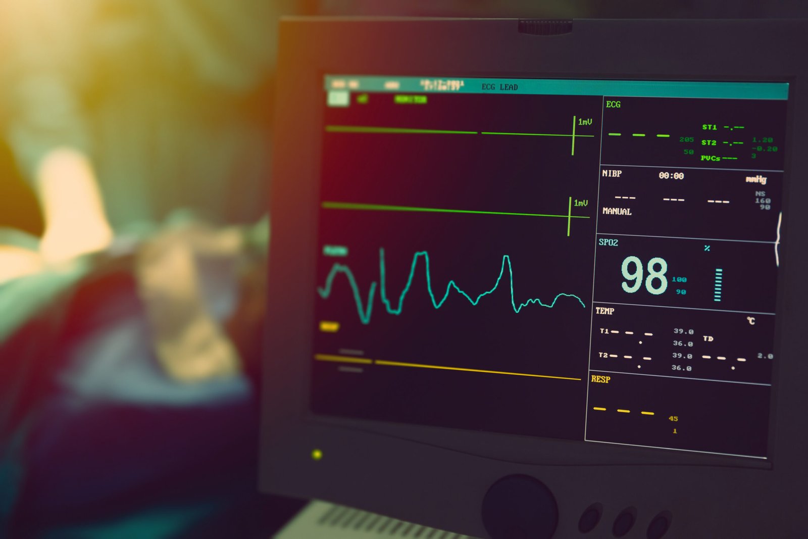 ECG test at Northern Heart Hospital assessing heart’s electrical activity