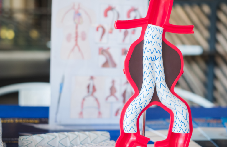 Endovascular Aneurysm Repair