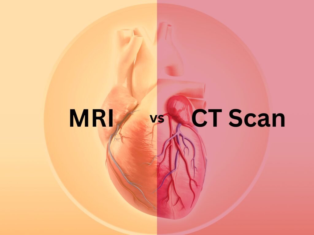 Cardiac MRI vs CT Scan