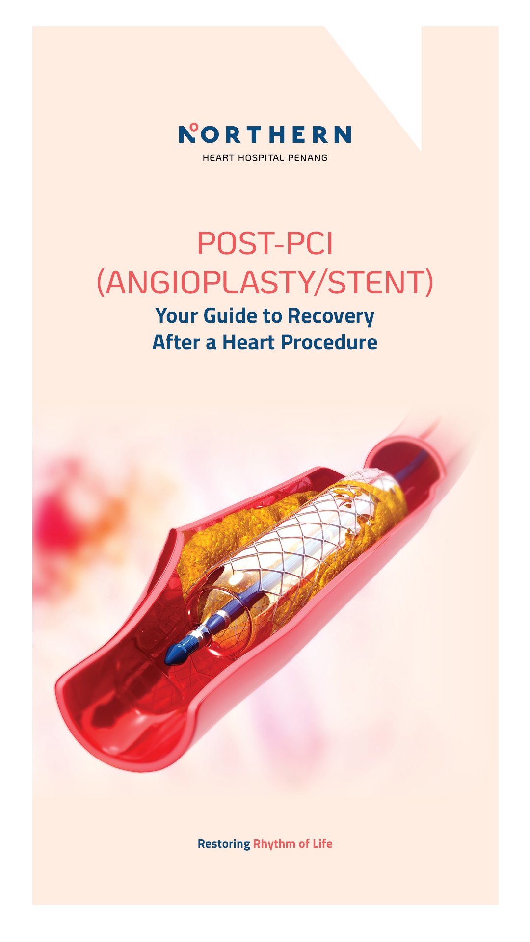 Post-PCI cover image